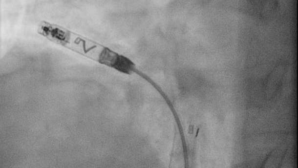 Kardiologie am Klinikum Freising