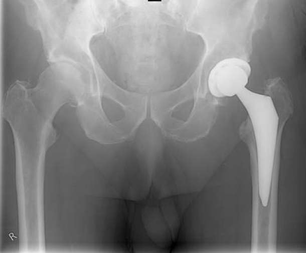 Orthopädie und Unfallchirurgie am Klinikum Freising